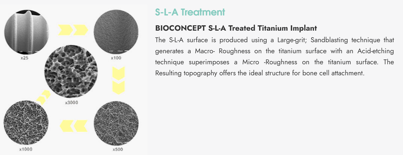 SLA Treatment